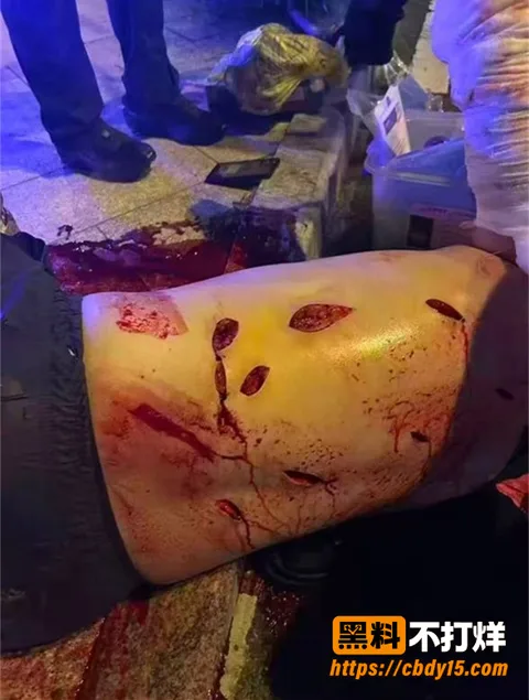 福建石狮八卦街醉汉驾车撞人后行凶 3 福建石狮八卦街醉汉驾车撞人后行凶 3